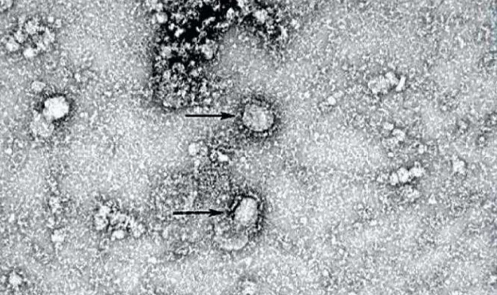 O isolamento de um vírus permite aos pesquisadores obter matéria-prima para estudar a doença