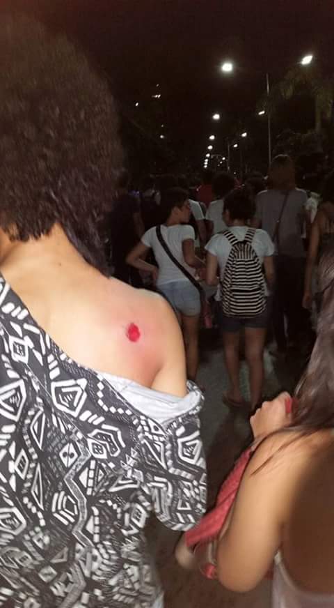 Jovem foi atingido no ombro por policial militar durante passeata (Foto: Reprodução/ Facebook Movimento#OcupeEstelita)