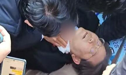 Lee Jae Myung foi esfaqueado no pescoço por suspeito que se passou de ‘apoiador’; a quatro meses das eleições parlamentares, porta-voz da sigla considerou ataque um ‘ato de destruição da democracia'