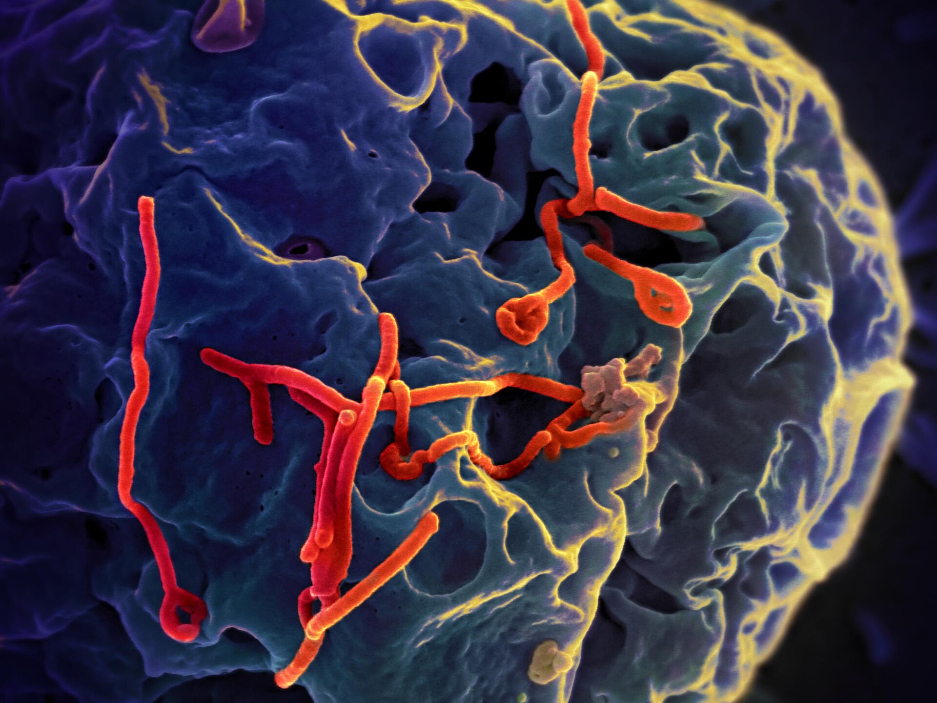 OMS declara emergência global por nova cepa do ebola na África