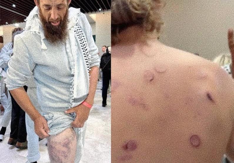 Itália investiga interceptação de flotilha por Israel após relatos de tortura e agressão sexual